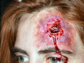 Bullet prosthetic