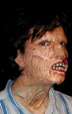 Freak prosthetic side